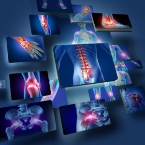 Orthopedic Surgery Instruments